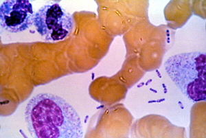 Il-mikrobu tal-pesta fid-demm